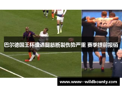 巴尔德国王杯遭遇腿筋断裂伤势严重 赛季提前报销